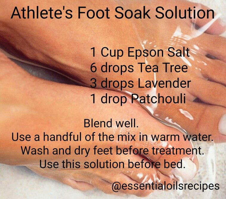 Athlete's foot Essential Oils NZ and Natural Pigmentation Skincare