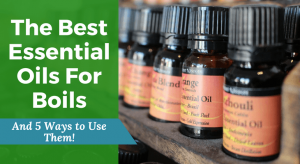 The-Best-Essential-Oils-For-Boils