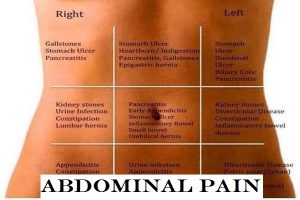 abdominal-pain