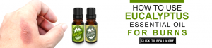 burns-essential-oils