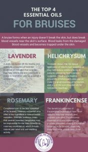 essential-oil-bruise-blend-oils-for-bruises