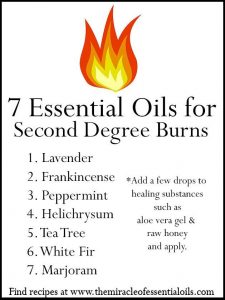 essential-oils-burns