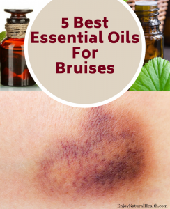 essential-oils-for-bruising
